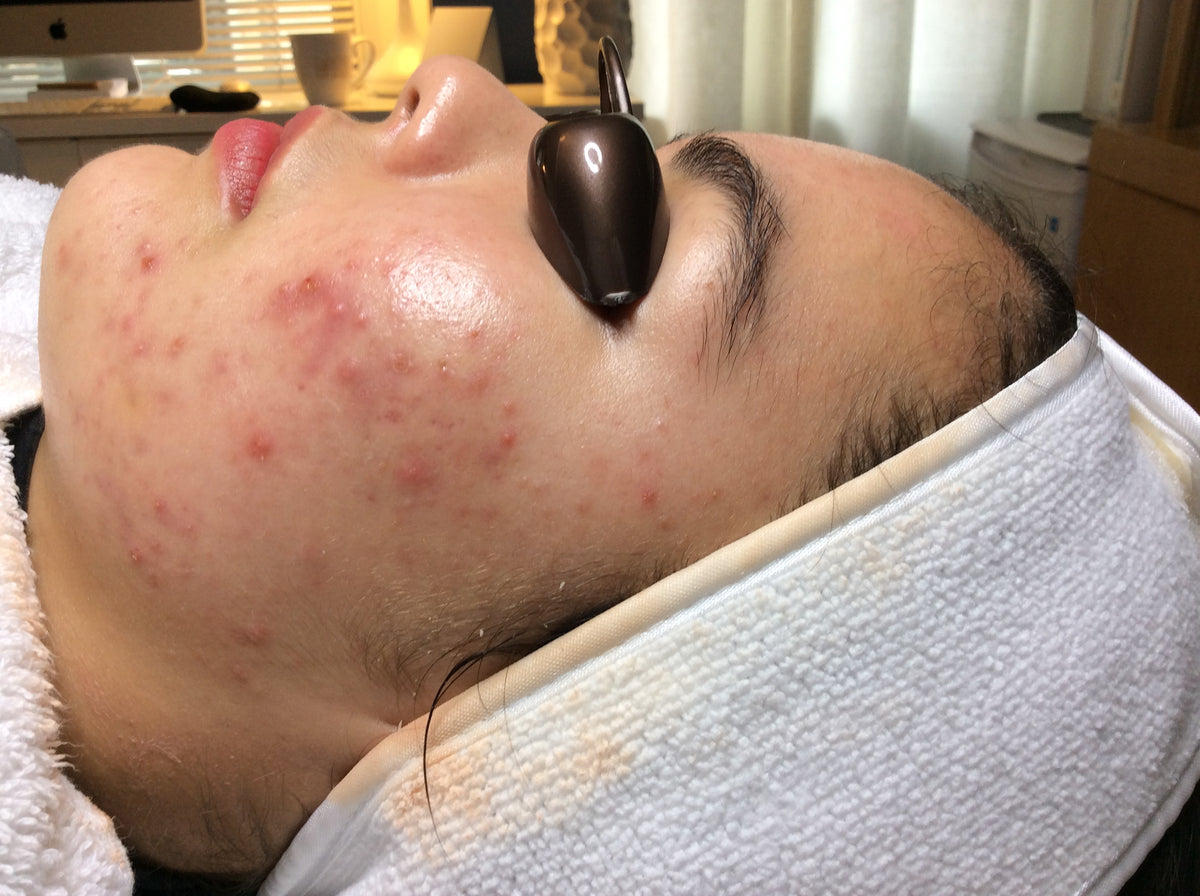 Clear Day Acne Clinic