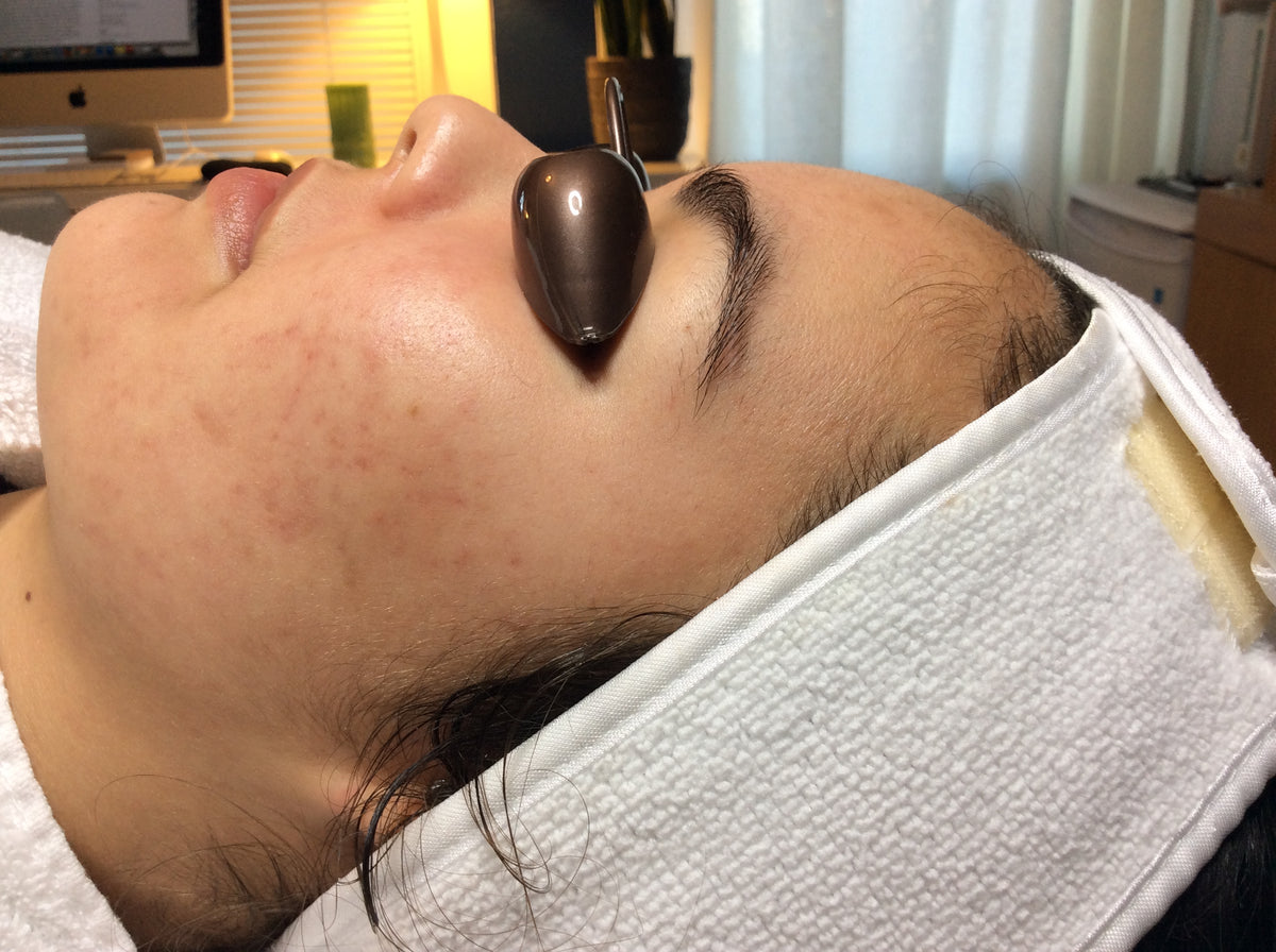 Clear Day Acne Clinic